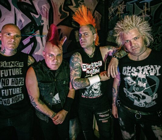 The Casualties
